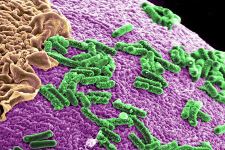 Microbiota y probióticos